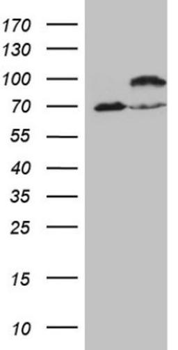 Western Blot: IKK epsilon/IKBKE Antibody (3C5) [NBP2-46047] - Analysis of HEK293T cells were transfected with the pCMV6-ENTRY control (Left lane) or pCMV6-ENTRY IKBKE.