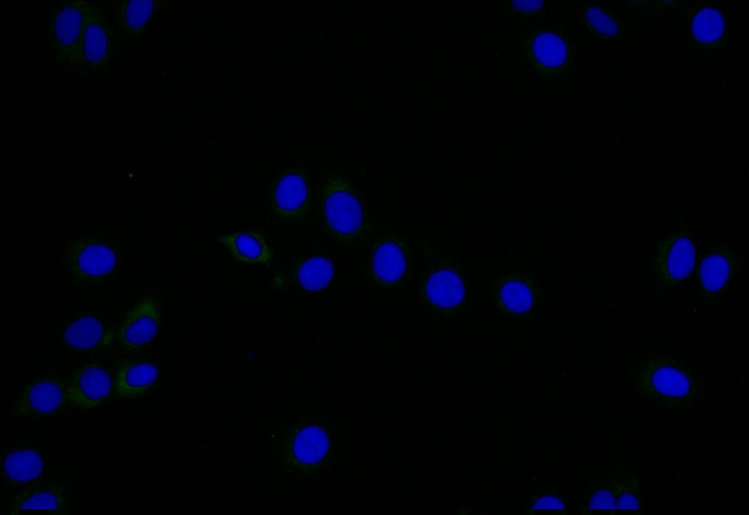 Immunofluorescence staining of HepG2 with CSB-RA949150A0HU at 1:25, counter-stained with DAPI. The cells were fixed in 4% formaldehyde and blocked in 10% normal Goat Serum. The cells were then incubated with the antibody overnight at 4°C. The secondary antibody was Alexa Fluor 505-congugated AffiniPure Goat Anti-Rabbit IgG(H+L).