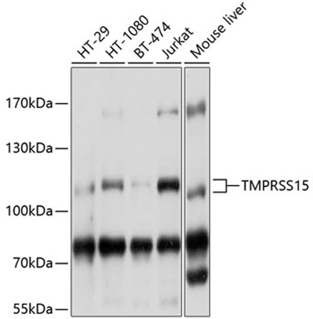 Western blot - TMPRSS15 antibody (A10239)