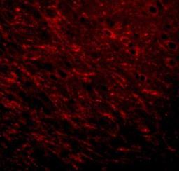 Immunocytochemistry/Immunofluorescence: ProSAPiP1 Antibody [NBP1-77369] - Immunofluorescence of Prosapip 1 in rat brain tissue with Prosapip 1 antibody at 20 ug/mL.