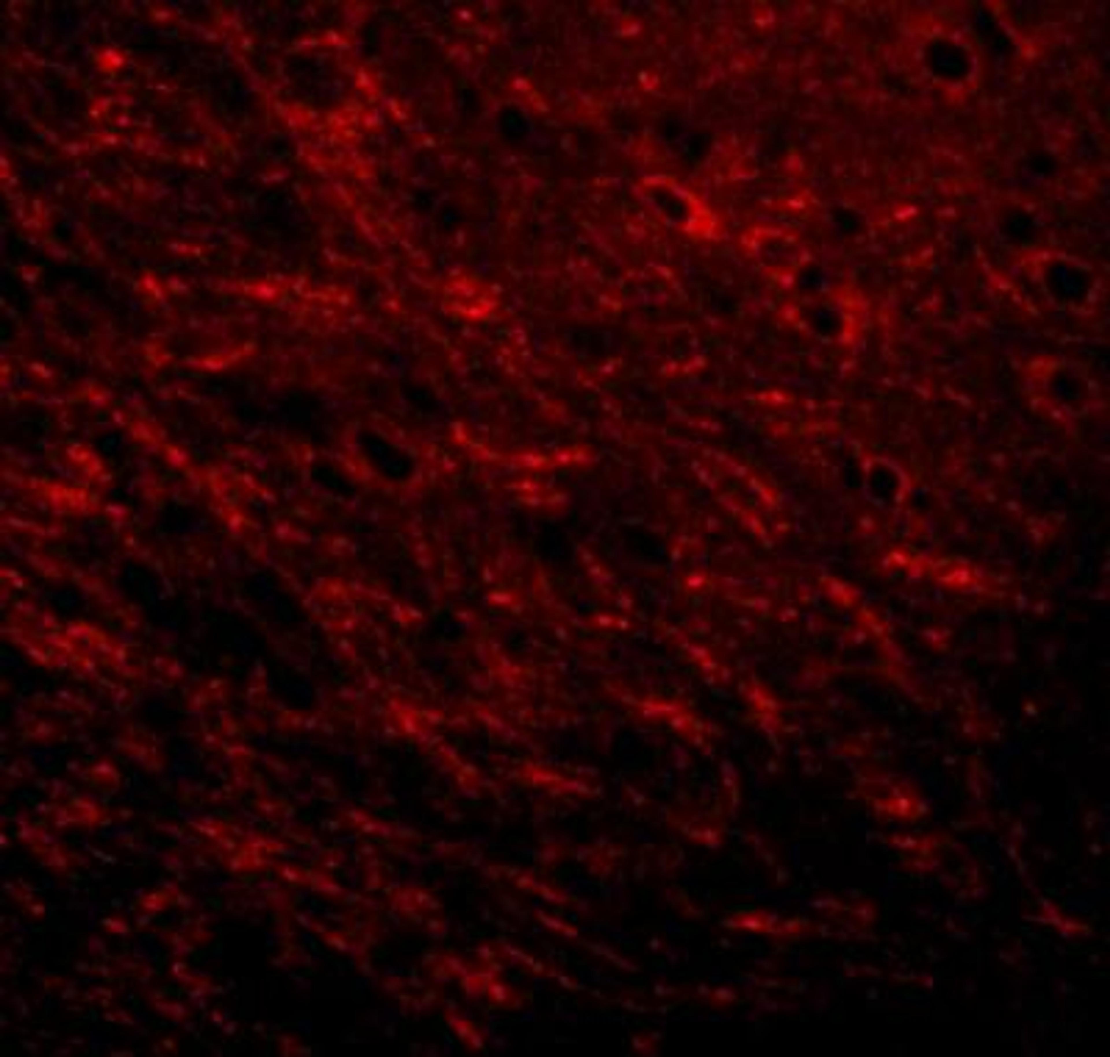 Immunocytochemistry/Immunofluorescence: ProSAPiP1 Antibody [NBP1-77369] - Immunofluorescence of Prosapip 1 in rat brain tissue with Prosapip 1 antibody at 20 ug/mL.