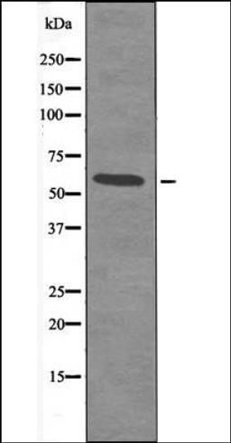 Western blot analysis of LOVO whole cell lysates using Smad2 -Phospho-Ser245- antibody