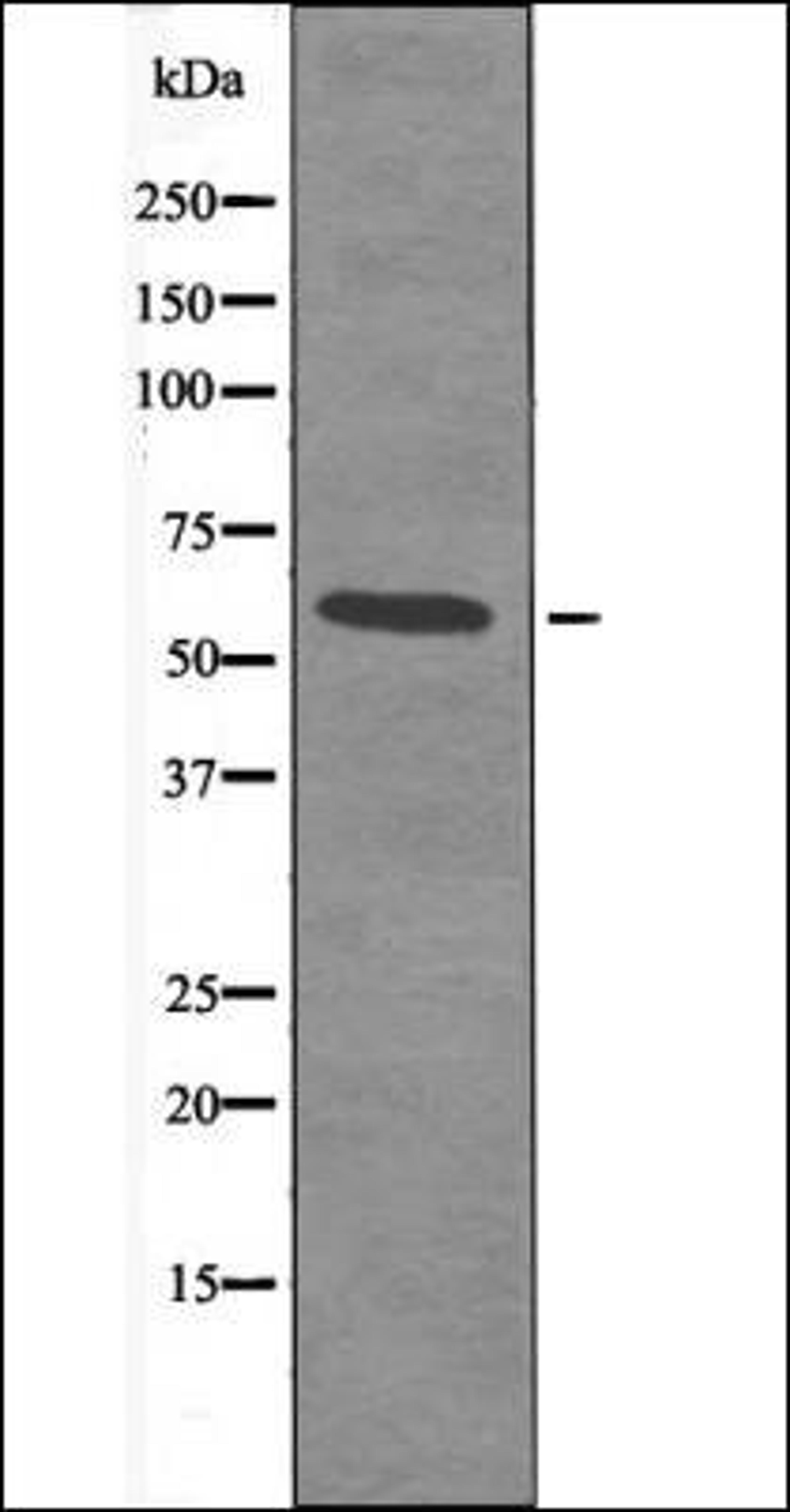 Western blot analysis of LOVO whole cell lysates using Smad2 -Phospho-Ser245- antibody