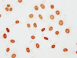 Immunocytochemistry analysis of CSB-PA010377OA48acHU diluted at 1:15 and staining in Hela cells(treated with 30mM sodium butyrate for 4h) performed on a Leica BondTM system. The cells were fixed in 4% formaldehyde, permeabilized using 0.2% Triton X-100 and blocked with 10% normal goat serum 30min at RT. Then primary antibody (1% BSA) was incubated at 4°C overnight. The primary is detected by a biotinylated secondary antibody and visualized using an HRP conjugated SP system.