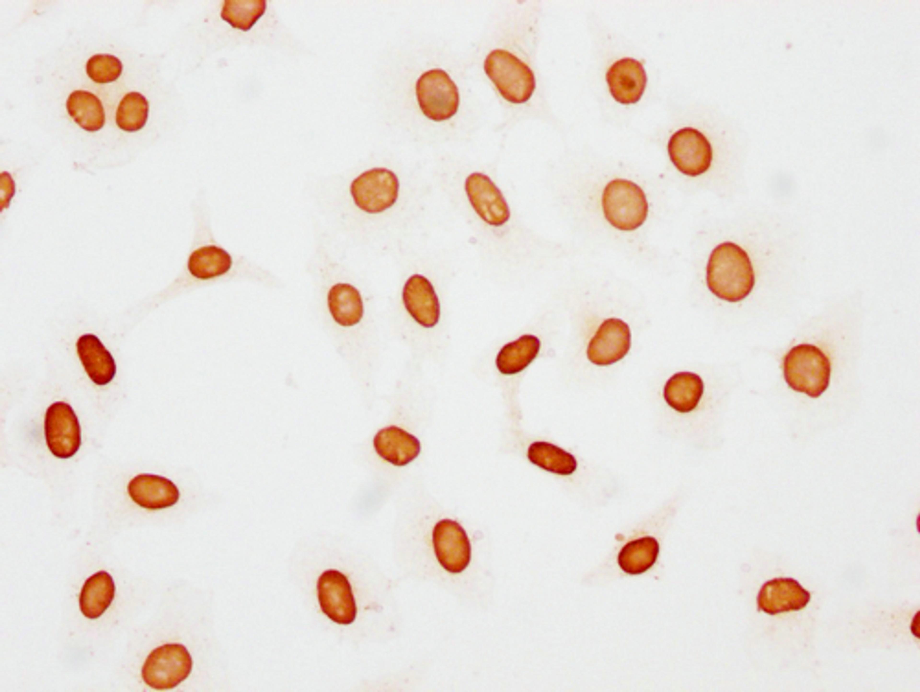 Immunocytochemistry analysis of CSB-PA010377OA48acHU diluted at 1:15 and staining in Hela cells(treated with 30mM sodium butyrate for 4h) performed on a Leica BondTM system. The cells were fixed in 4% formaldehyde, permeabilized using 0.2% Triton X-100 and blocked with 10% normal goat serum 30min at RT. Then primary antibody (1% BSA) was incubated at 4°C overnight. The primary is detected by a biotinylated secondary antibody and visualized using an HRP conjugated SP system.