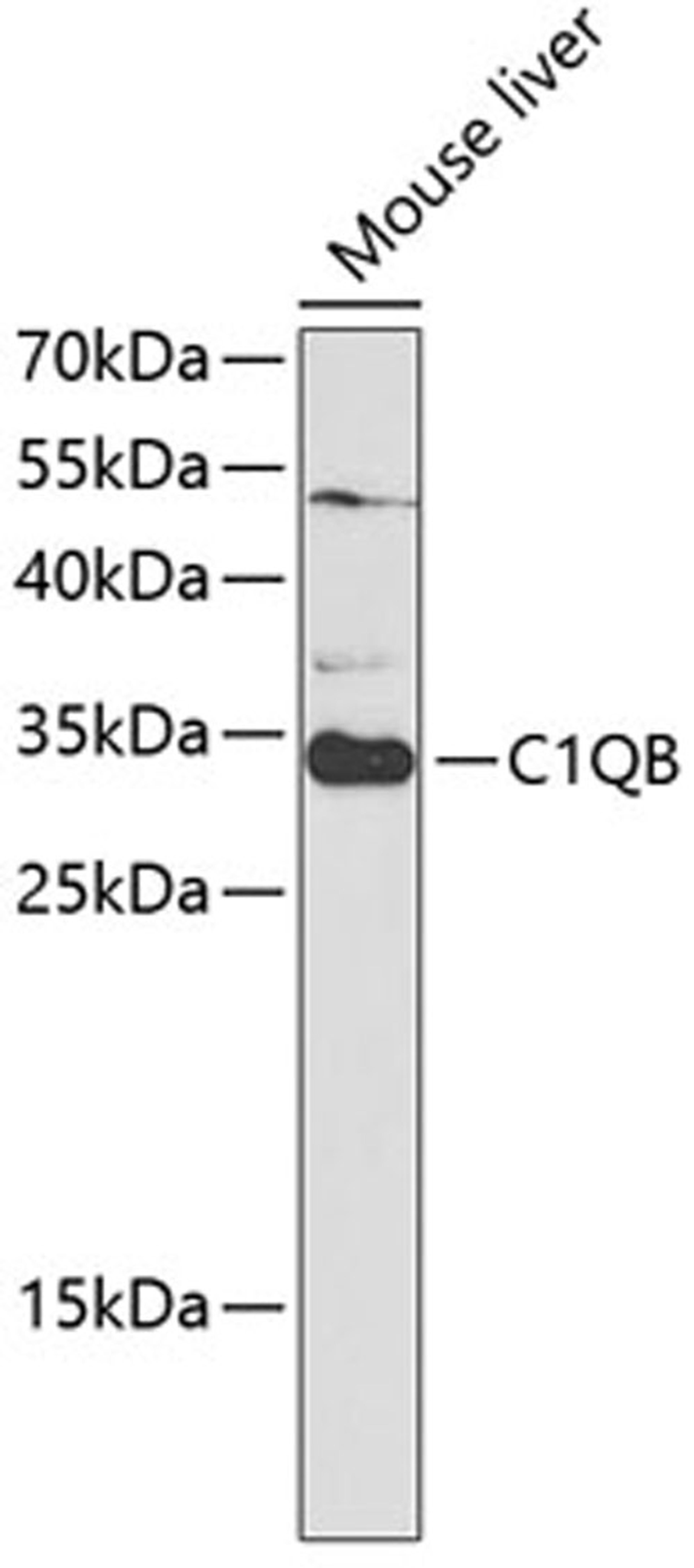 Western blot - C1QB antibody (A5339)