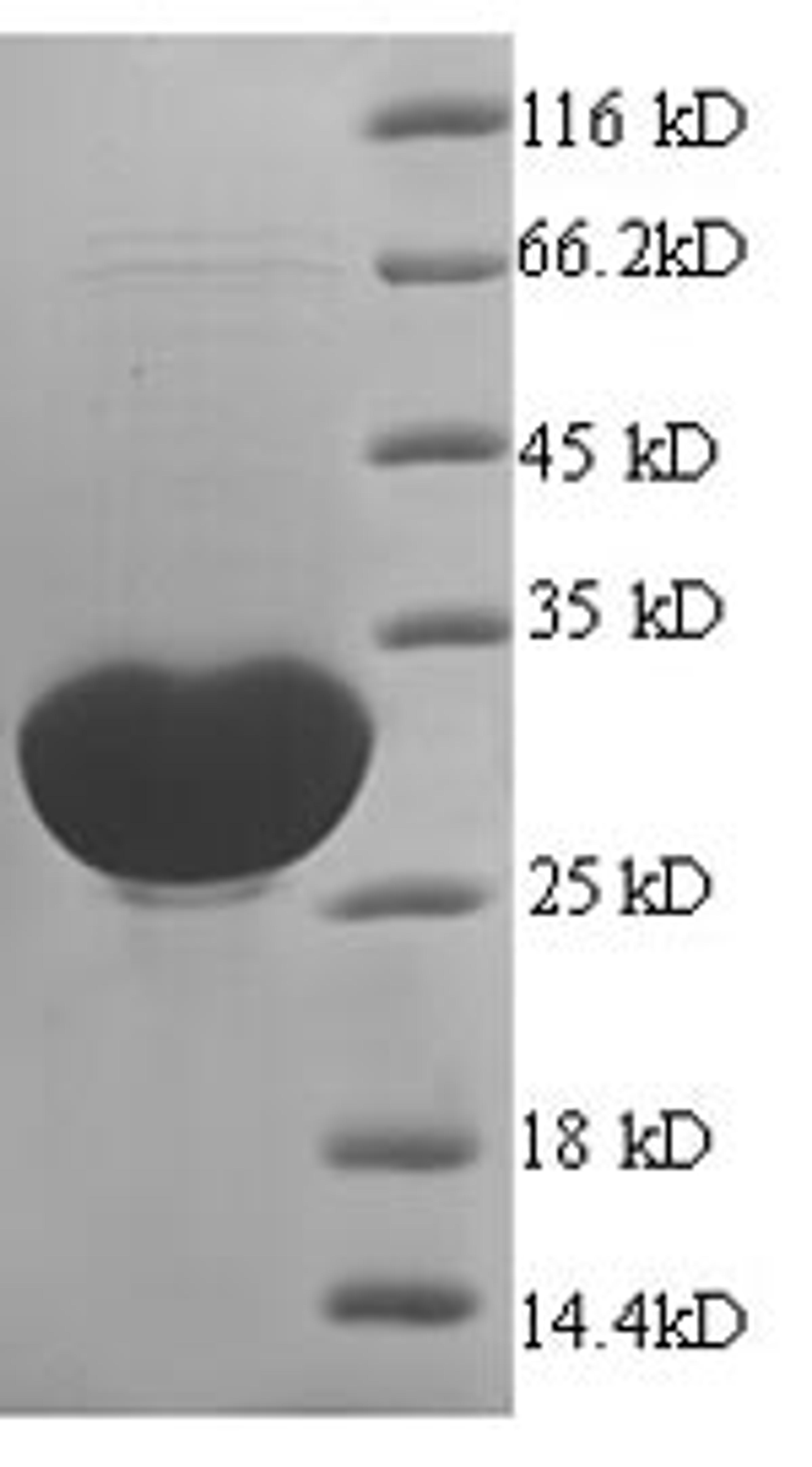 (Tris-Glycine gel) Discontinuous SDS-PAGE (reduced) with 5% enrichment gel and 15% separation gel.