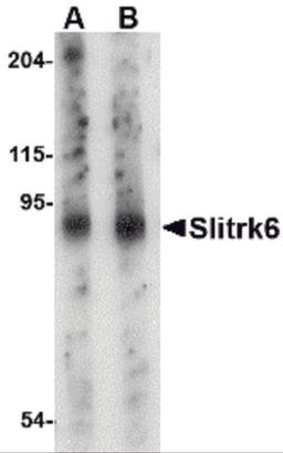 Western blot analysis of Slitrk6 in mouse lung tissue lysate with Slitrk6 antibody at (A) 0.5 and (B) 1 &#956;g/mL.