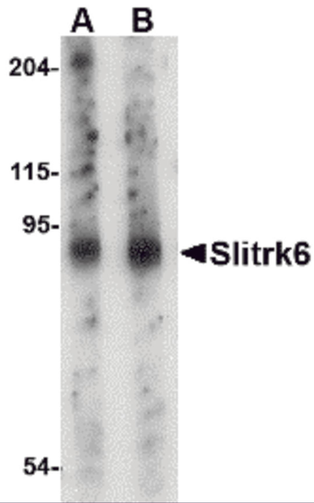 Western blot analysis of Slitrk6 in mouse lung tissue lysate with Slitrk6 antibody at (A) 0.5 and (B) 1 μg/mL.