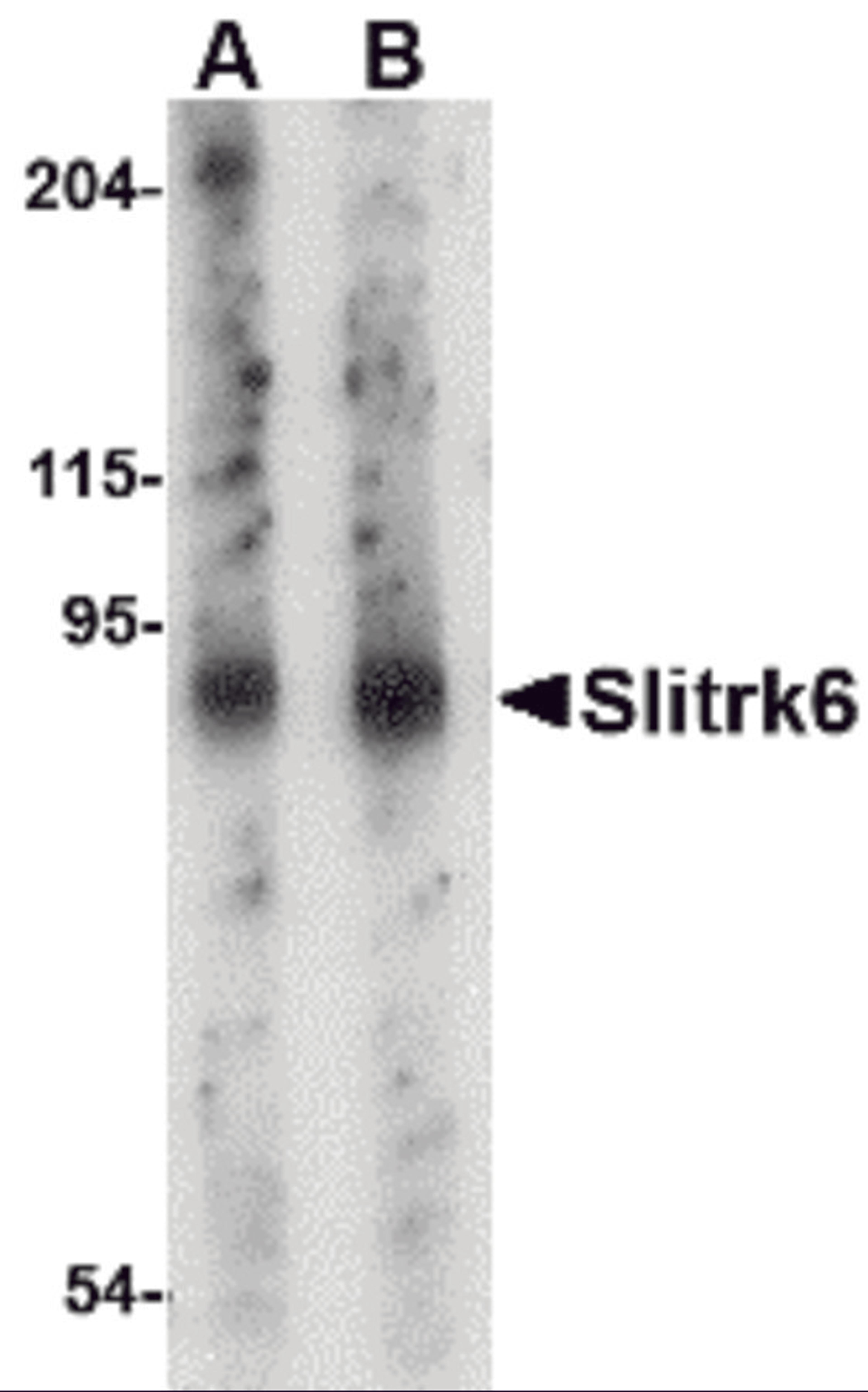 Western blot analysis of Slitrk6 in mouse lung tissue lysate with Slitrk6 antibody at (A) 0.5 and (B) 1 μg/mL.