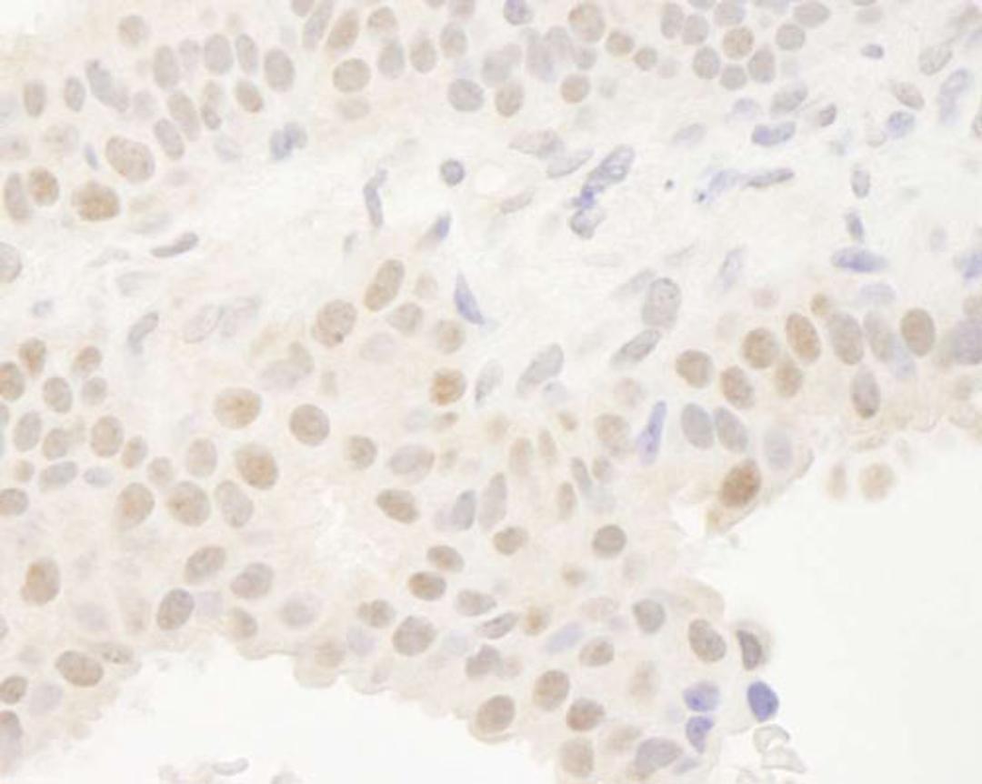 Detection of human Dec1 by IHC.