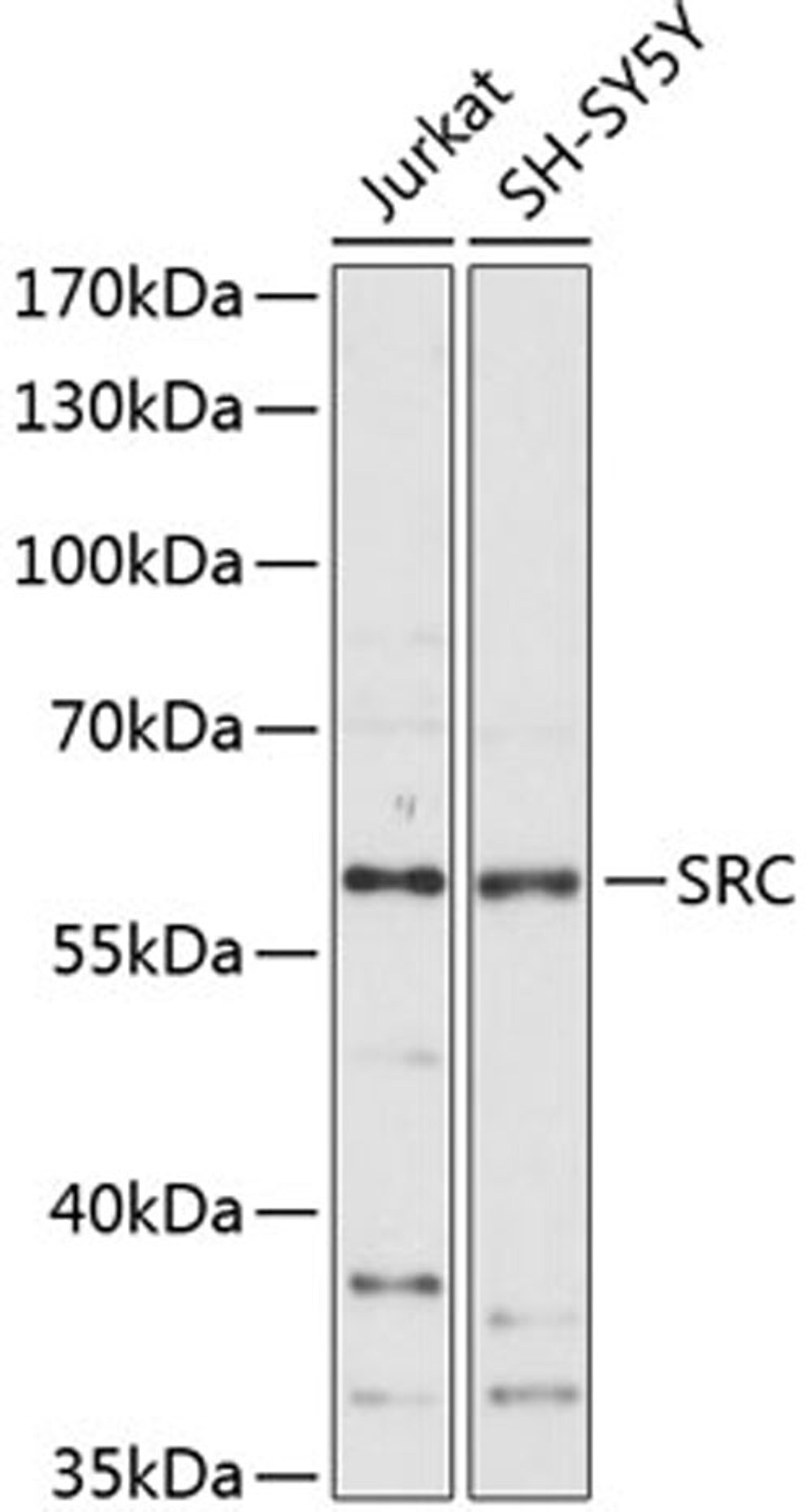 Western blot - SRC antibody (A11707)