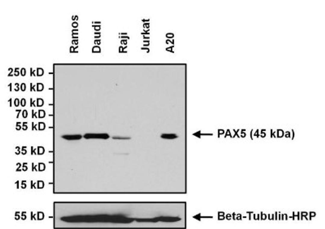 Western Blot: Pax5/BSAP Antibody [NBP2-29905] - Analysis of 75ug of whole cell lysates from PAX5-expressing B cell lymphoma-derived cell lines, negative control Jurkat cells, and 10ul of PageRuler Plus Prestained Protein Ladder.