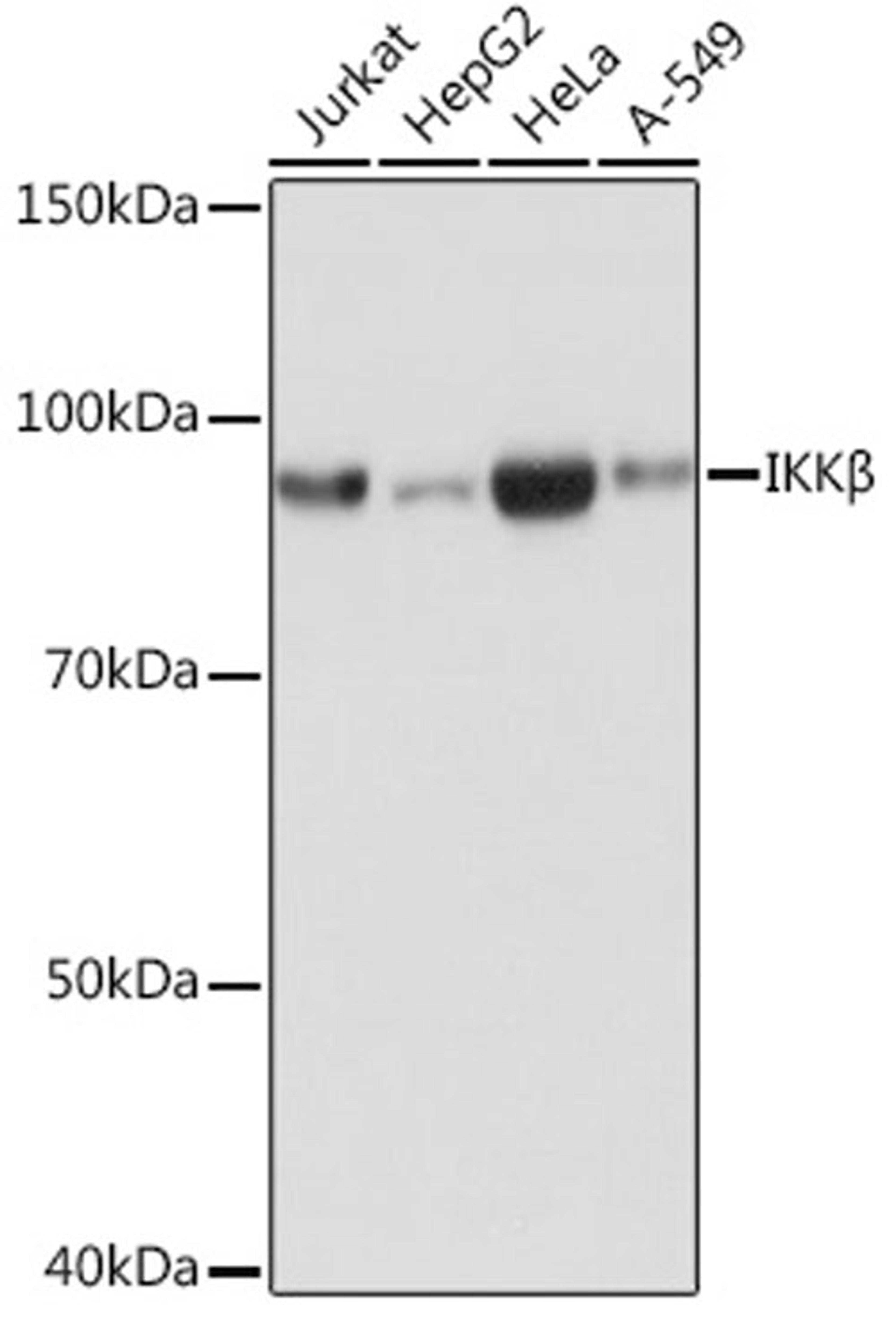 Western blot - IKKß antibody (A19606)