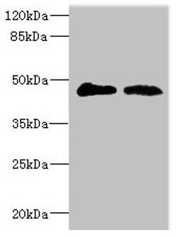 Western blot. All lanes: GCNT2 antibody at 3.99µg/ml. Lane 1: 293T whole cell lysate. Lane 2: Mouse placenta tissue. Secondary. Goat polyclonal to rabbit IgG at 1/10000 dilution. Predicted band size: 46, 47 kDa. Observed band size: 46 kDa