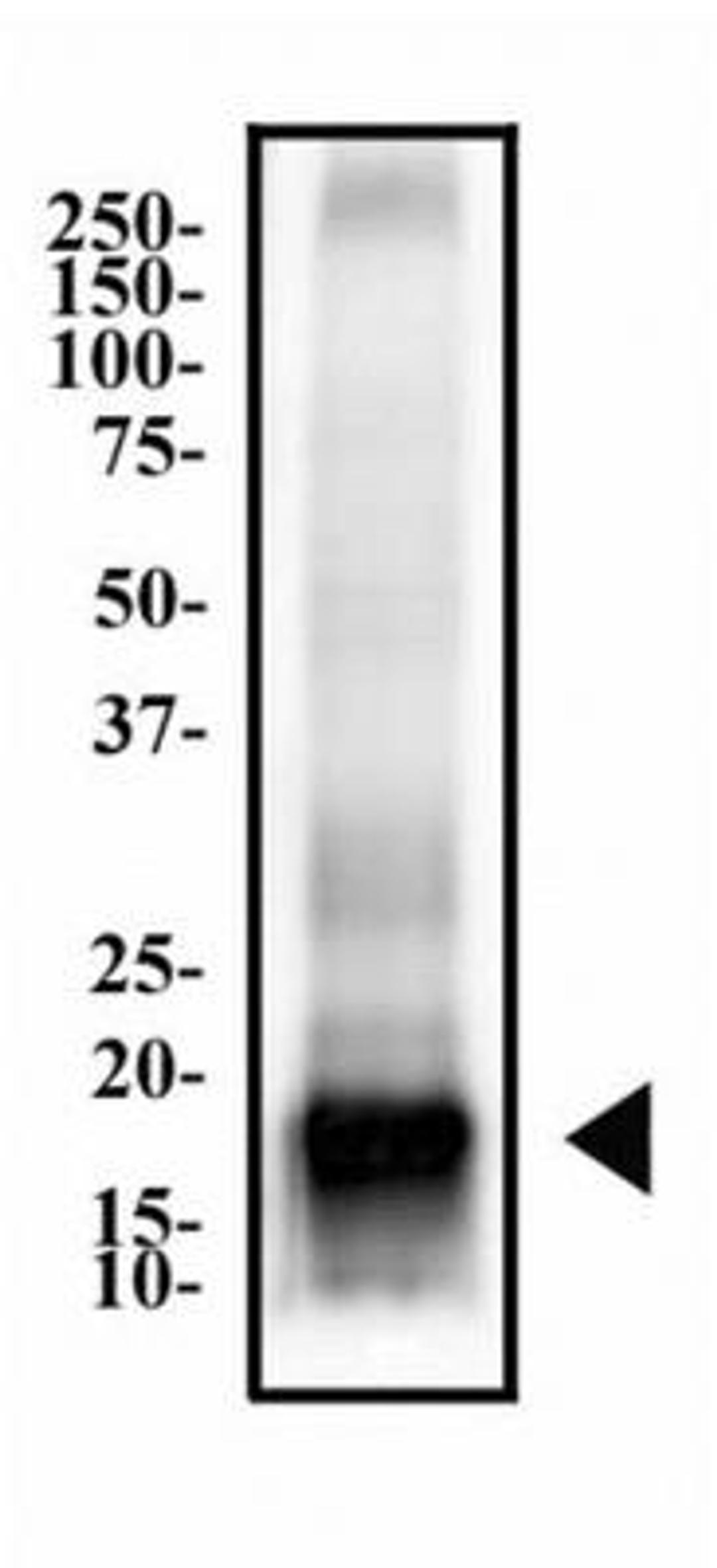 Western Blot: MBP Antibody (2H9) [NBP2-22121] - Total human brain lysate was separated by SDS-PAGE on a 12% gel and transferred to PVDF membrane. The membrane was then probed with anti-MBP antibody at 2 ug/ml and detected using an anti-mouse HRP labeled secondary antibody and chemiluminescent substrate.