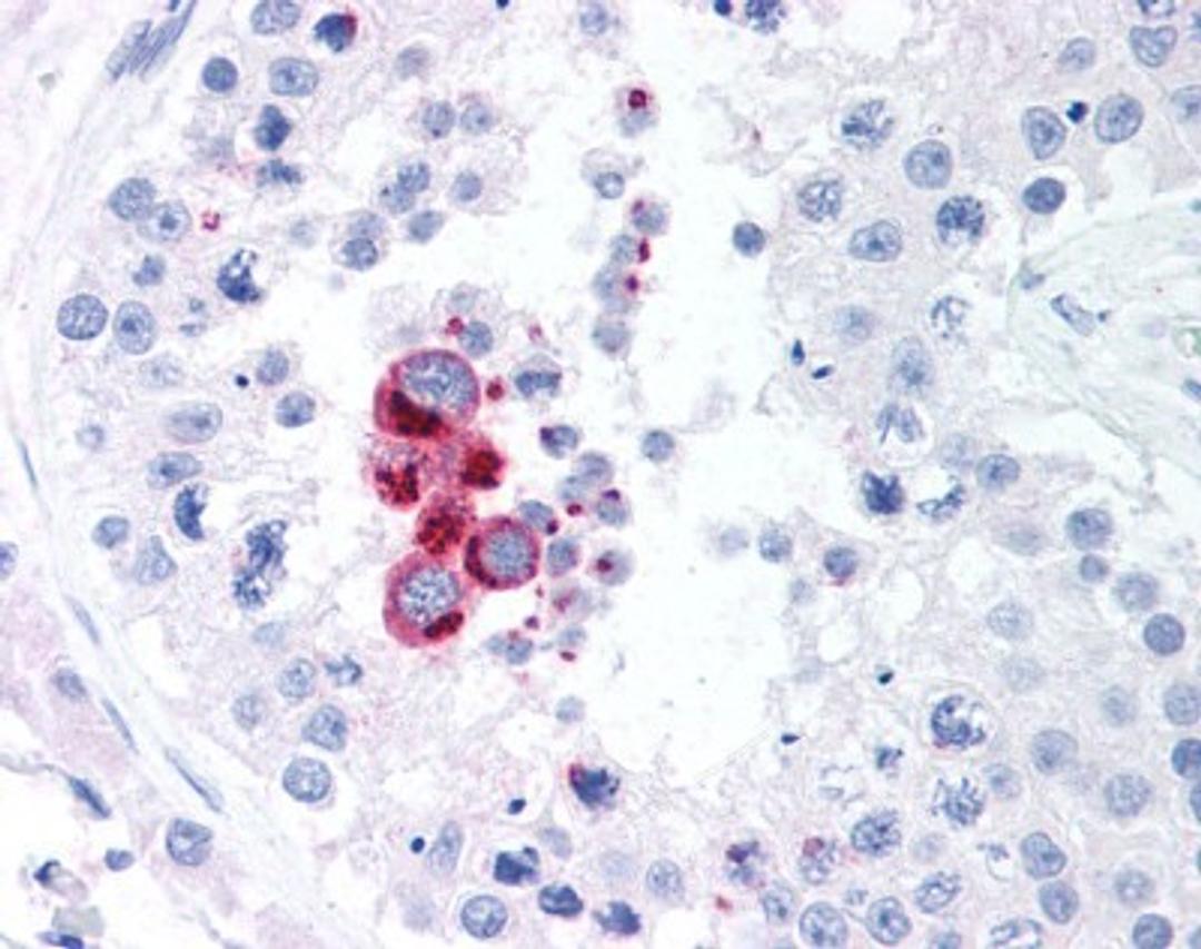 Immunohistochemistry-Paraffin: NAK Antibody (108A429) [NB100-56705] - IHC on human testis (Formalin-Fixed Paraffin-Embedded (FFPE))