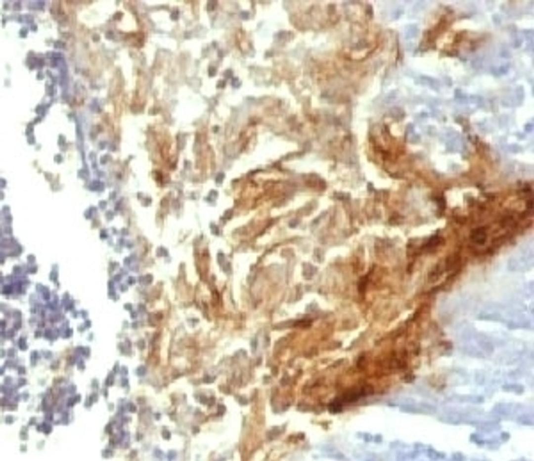 IHC testing of FFPE human tonsil with Involucrin antibody (clone INVO49)