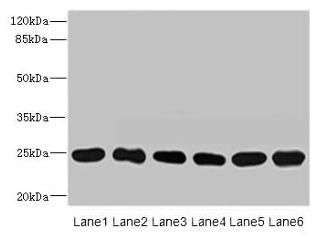 Western blot. All lanes: FKBP14 antibody at 1µg/ml. Lane 1: Mouse stomach tissue. Lane 2: Mouse gonadal tissue. Lane 3: U937 whole cell lysate. Lane 4: PC-3 whole cell lysate. Lane 5: 293T whole cell lysate. Lane 6: THP-1 whole cell lysate. Secondary. Goat polyclonal to rabbit IgG at 1/10000 dilution. Predicted band size: 25 kDa. Observed band size: 25 kDa