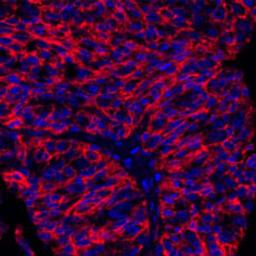 Detection of human B7-H3/CD276 (red) by immunohistochemistry.