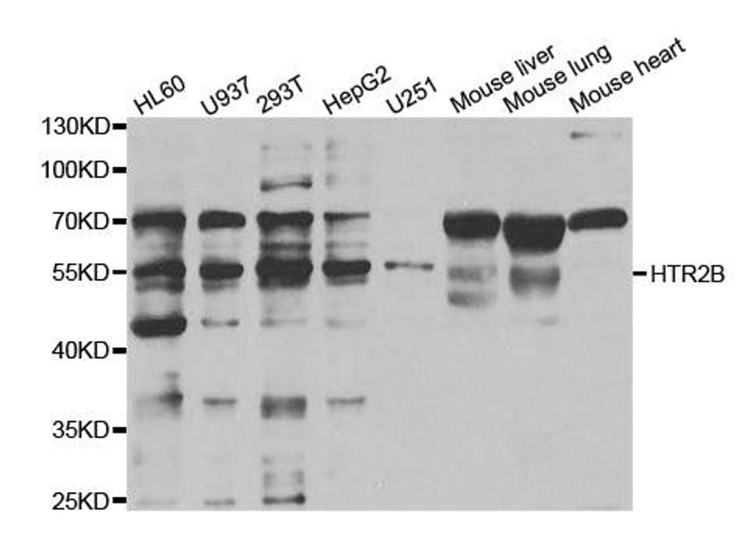 Western blot analysis of extracts of various cell lines using HTR2B antibody