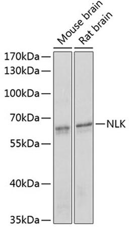 Western blot - NLK antibody (A3190)