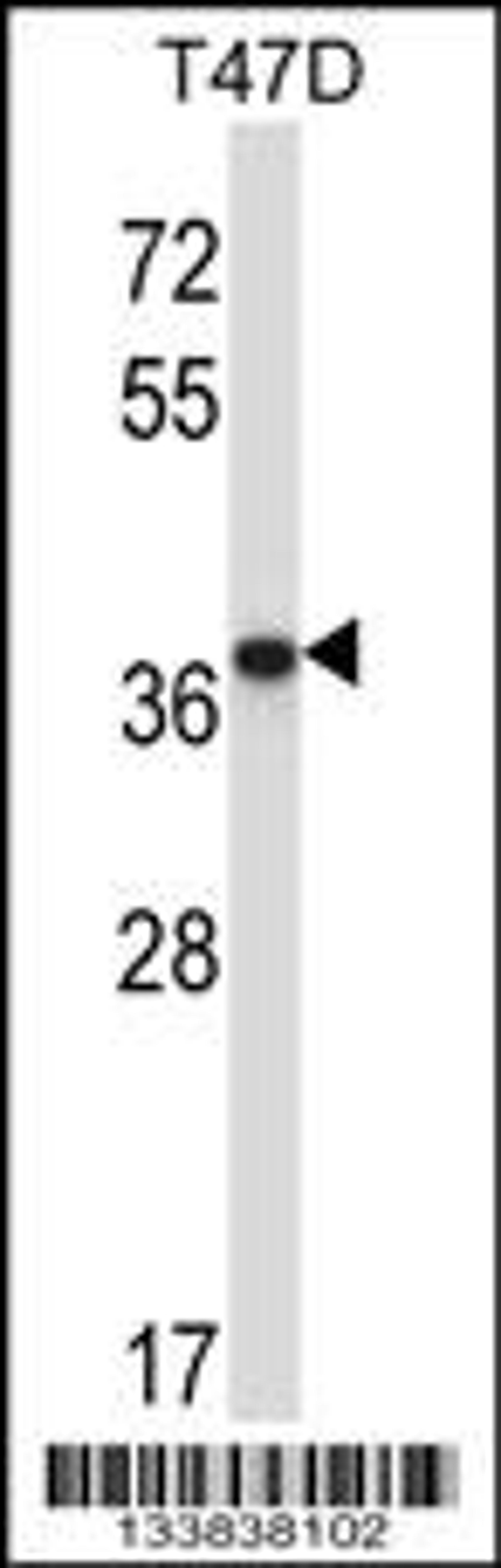 Western blot analysis in T47D cell line lysates (35ug/lane).