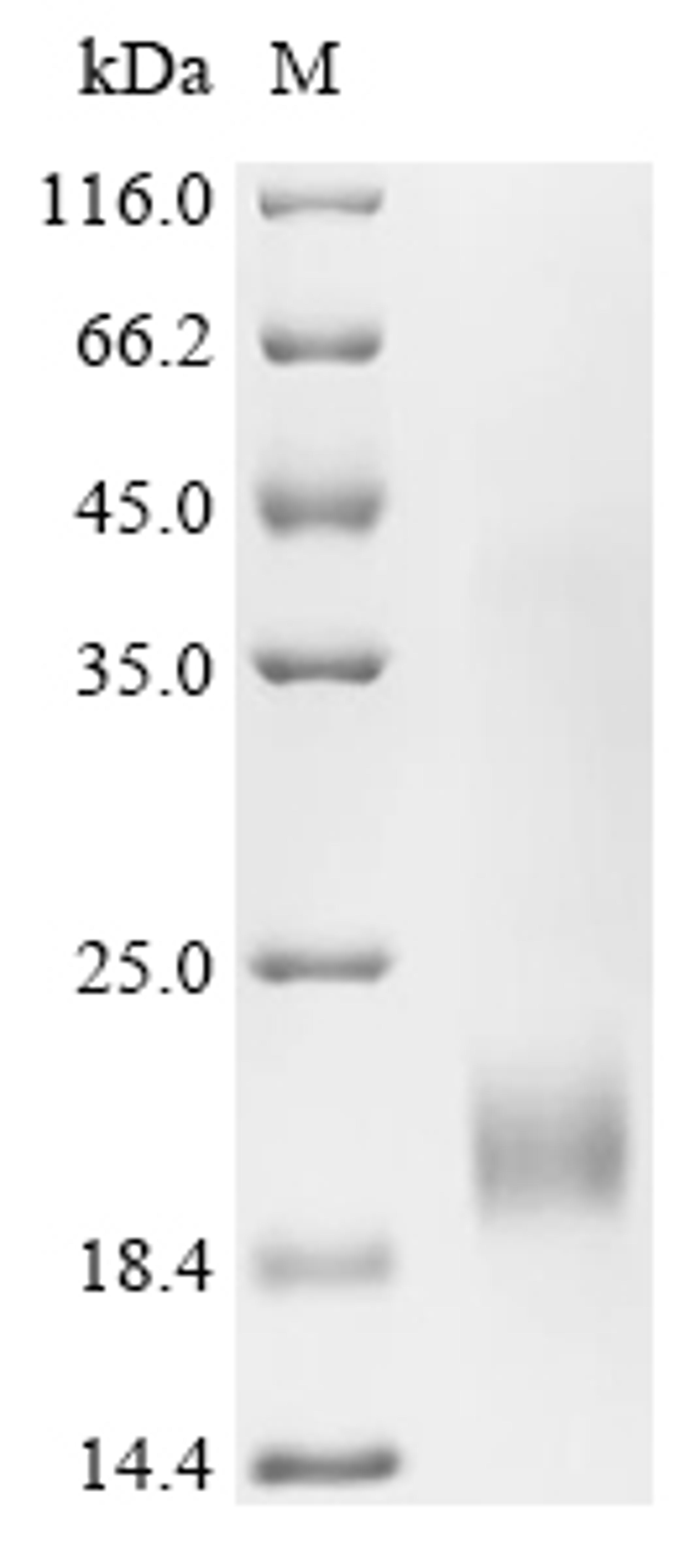 (Tris-Glycine gel) Discontinuous SDS-PAGE (reduced) with 5% enrichment gel and 15% separation gel.
