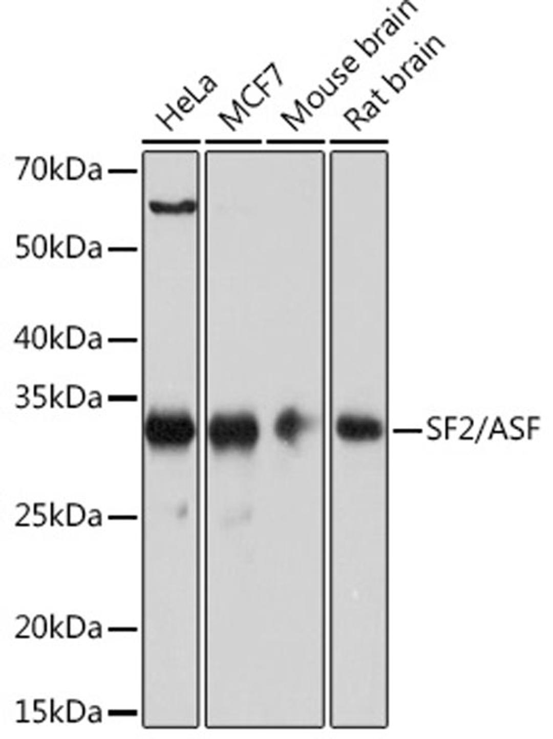 Western blot - SF2/ASF Rabbit mAb (A4091)