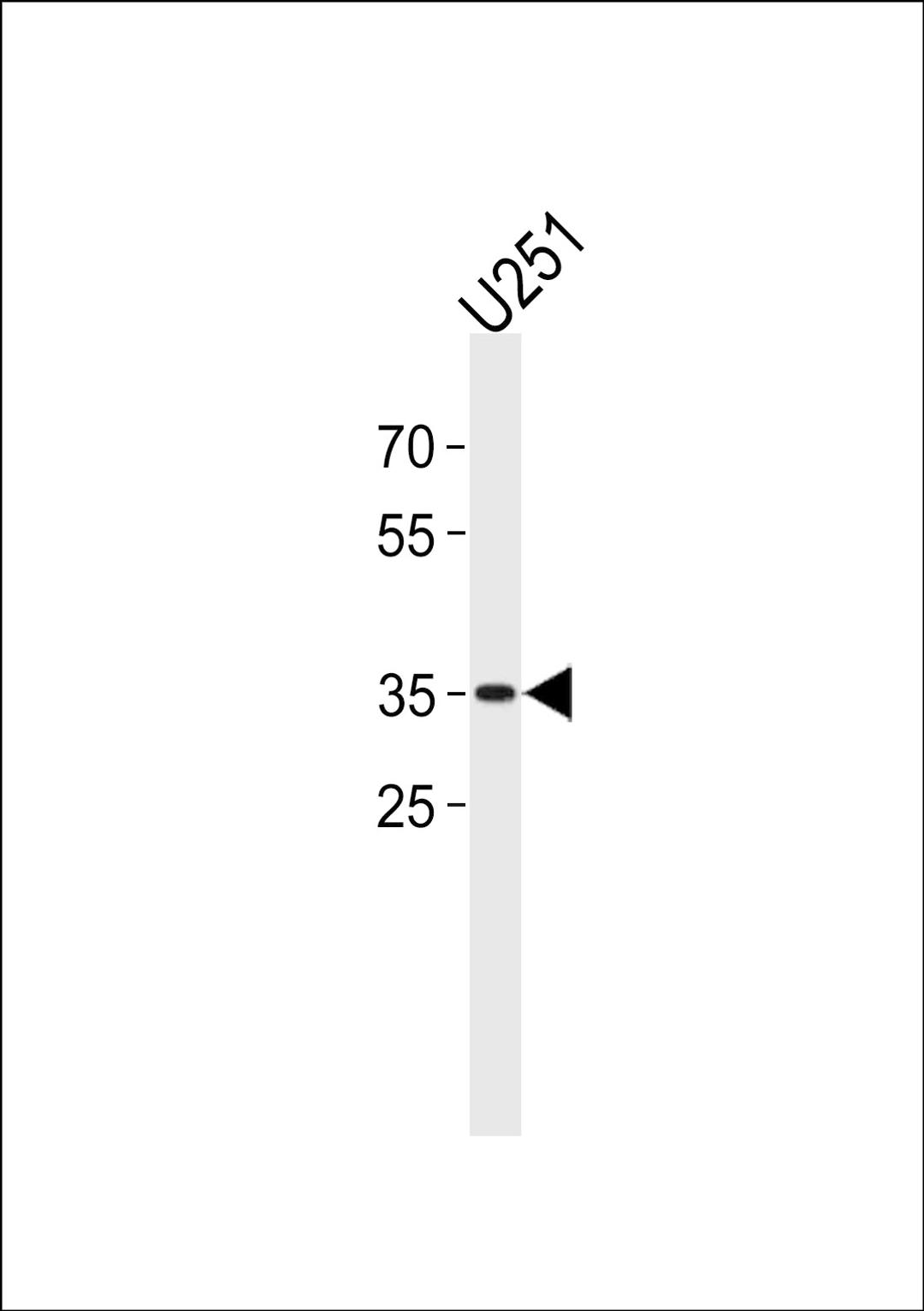 Western blot analysis in U251 cell line lysates (35ug/lane).