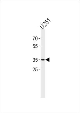 Western blot analysis in U251 cell line lysates (35ug/lane).