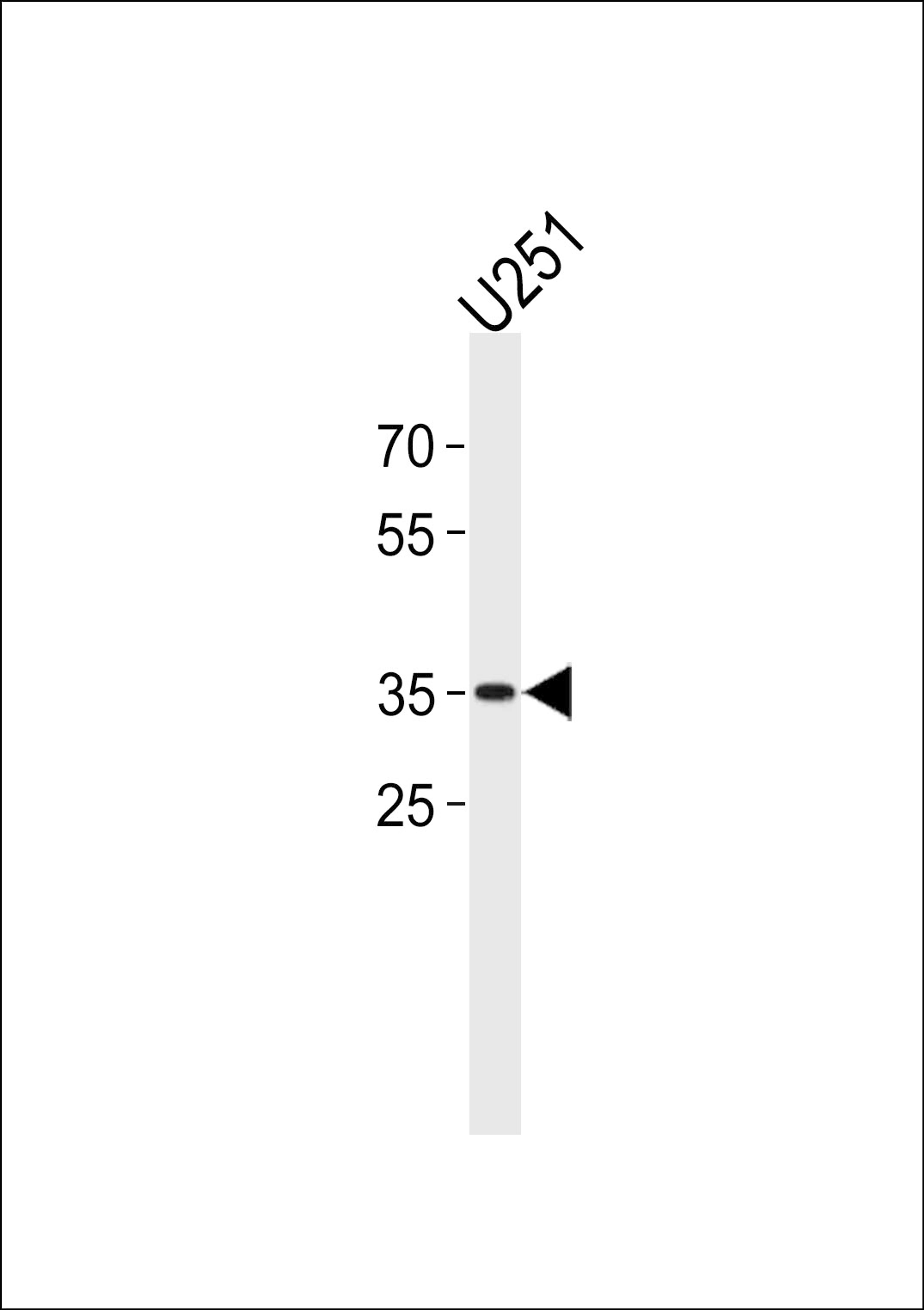 Western blot analysis in U251 cell line lysates (35ug/lane).