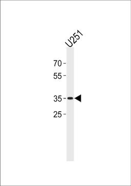 Western blot analysis in U251 cell line lysates (35ug/lane).