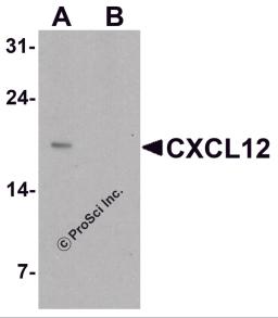 Western blot analysis of CXCL12 in HeLa cell lysate with CXCL12 antibody at 1 &#956;g/ml in (A) the absence and (B) the presence of blocking peptide.