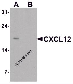 Western blot analysis of CXCL12 in HeLa cell lysate with CXCL12 antibody at 1 μg/ml in (A) the absence and (B) the presence of blocking peptide.