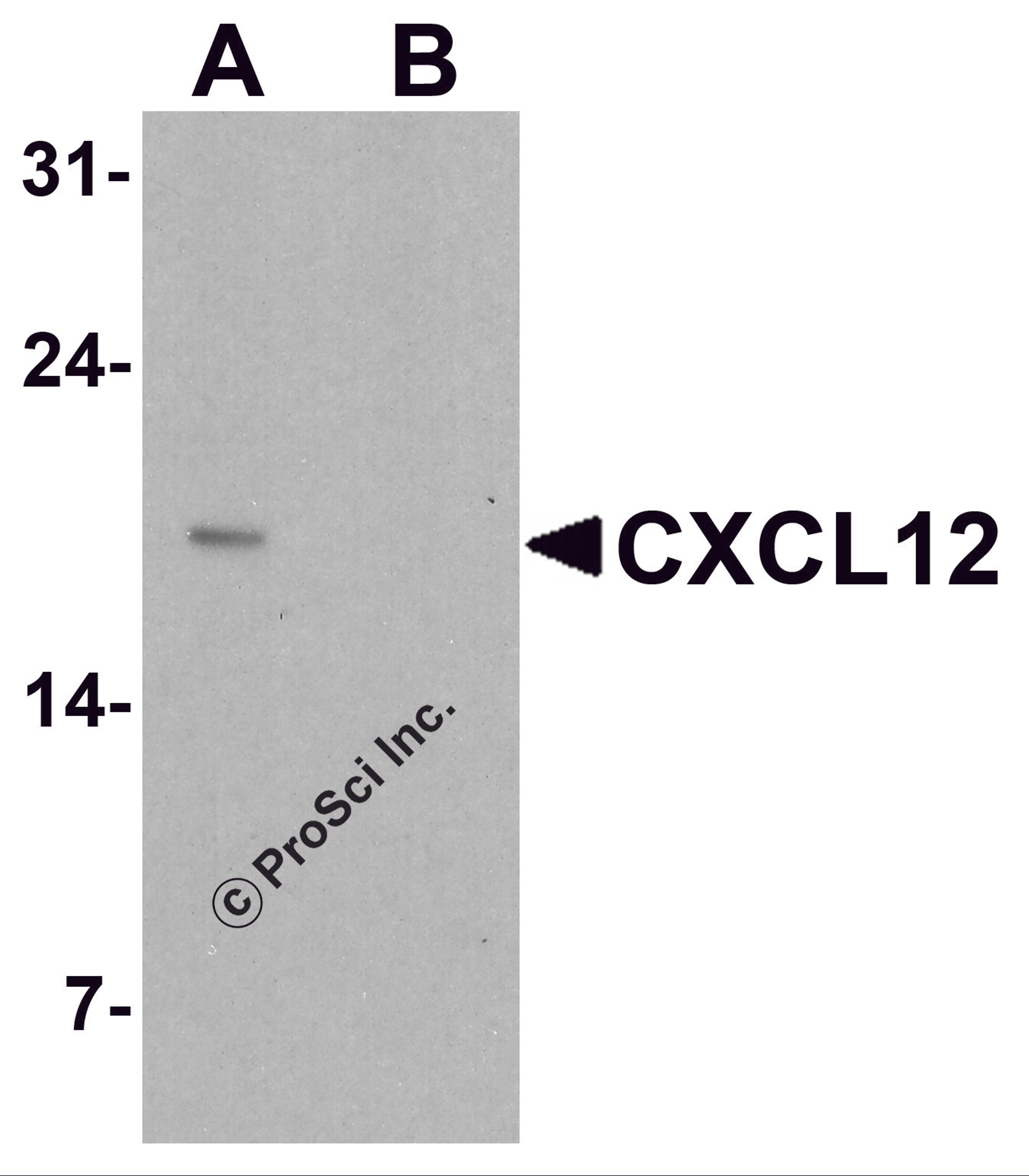 Western blot analysis of CXCL12 in HeLa cell lysate with CXCL12 antibody at 1 μg/ml in (A) the absence and (B) the presence of blocking peptide.