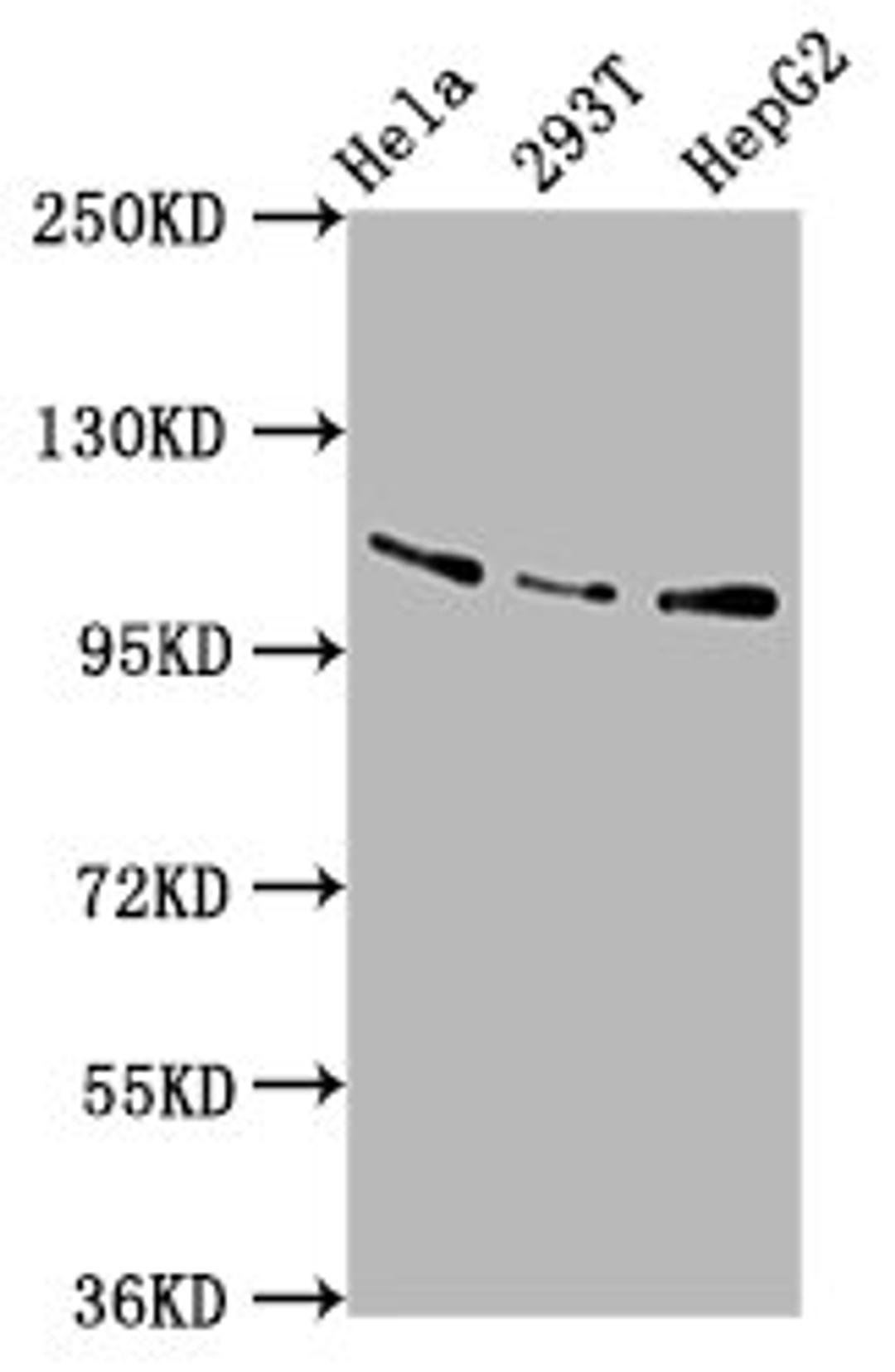 Western Blot. Positive WB detected in: Hela whole cell lysate, 293T whole cell lysate, HepG2 whole cell lysate. All lanes: AASS antibody at 5.8µg/ml. Secondary. Goat polyclonal to rabbit IgG at 1/50000 dilution. Predicted band size: 103 kDa. Observed band size: 103 kDa