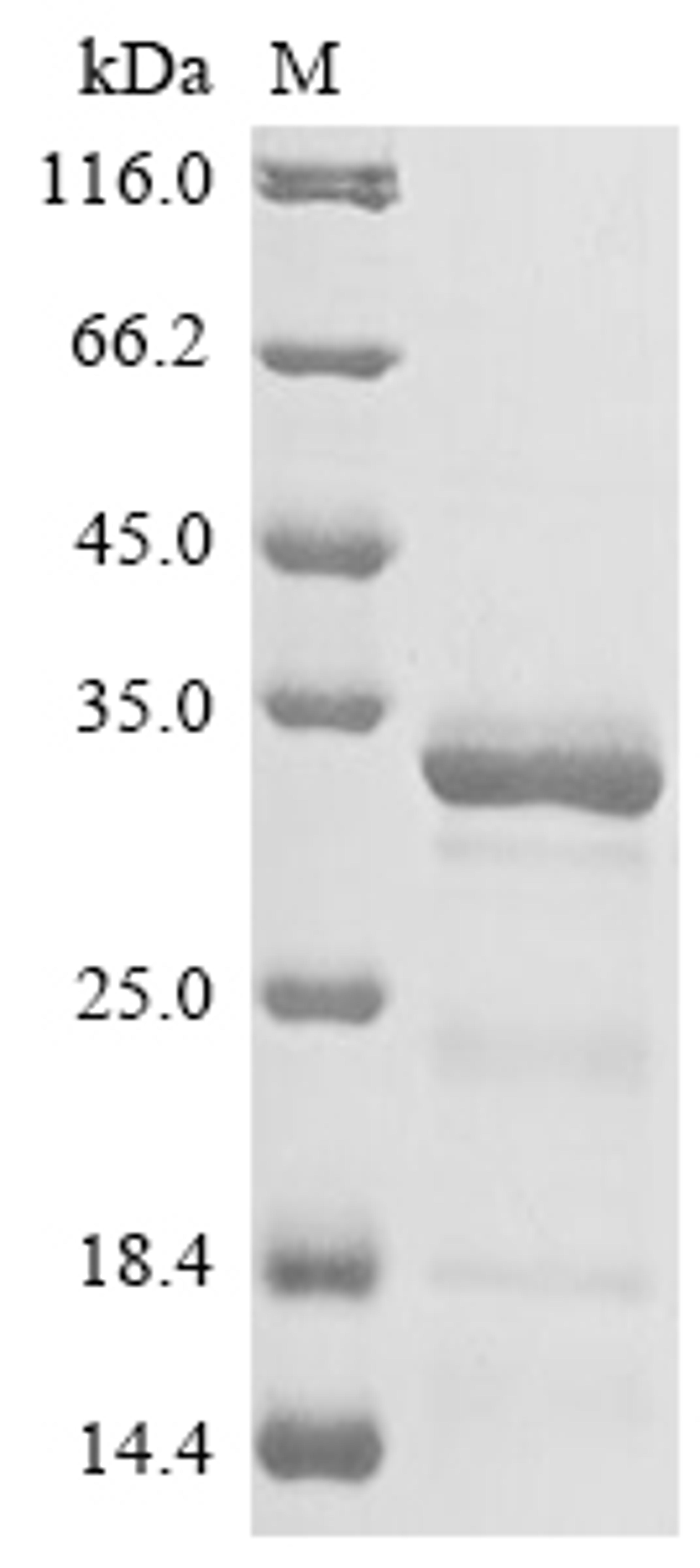 (Tris-Glycine gel) Discontinuous SDS-PAGE (reduced) with 5% enrichment gel and 15% separation gel.