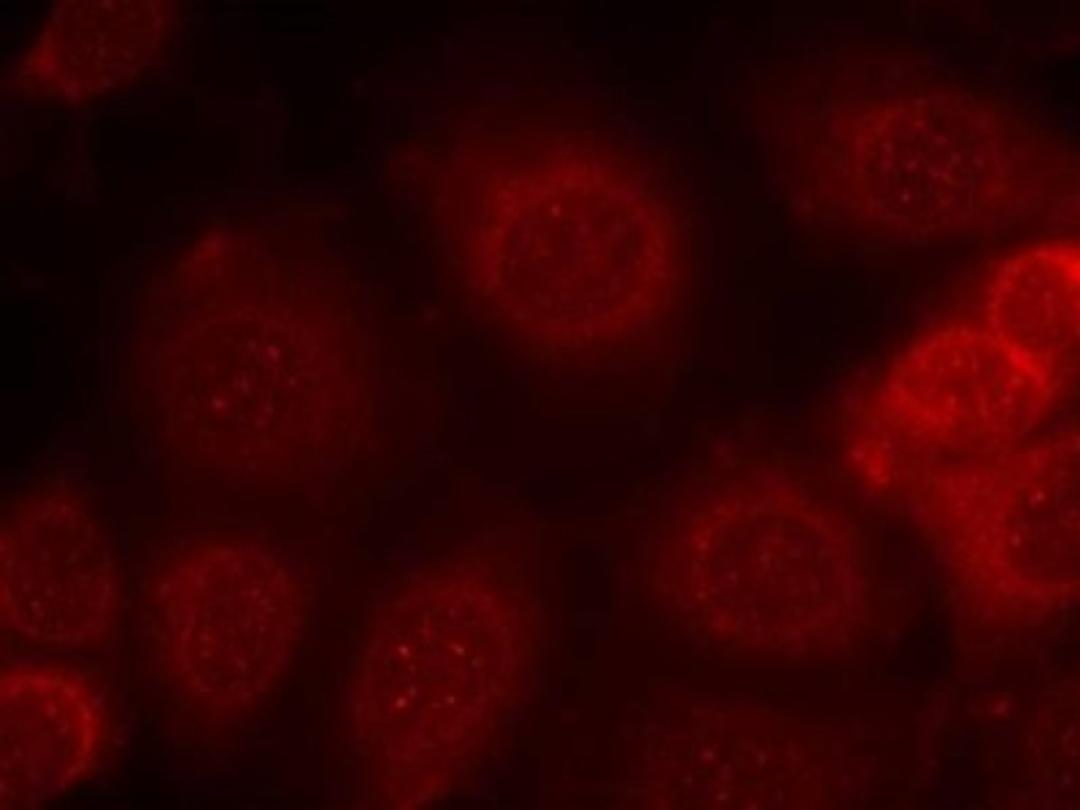 Immunocytochemistry/Immunofluorescence: PTEN [p Ser370] Antibody [NB100-82164] - Staining of methanol-fixed MCF7 cells using PTEN (phospho-Ser370) antibody