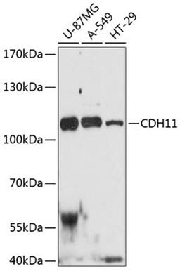 Western blot - CDH11 antibody (A12176)