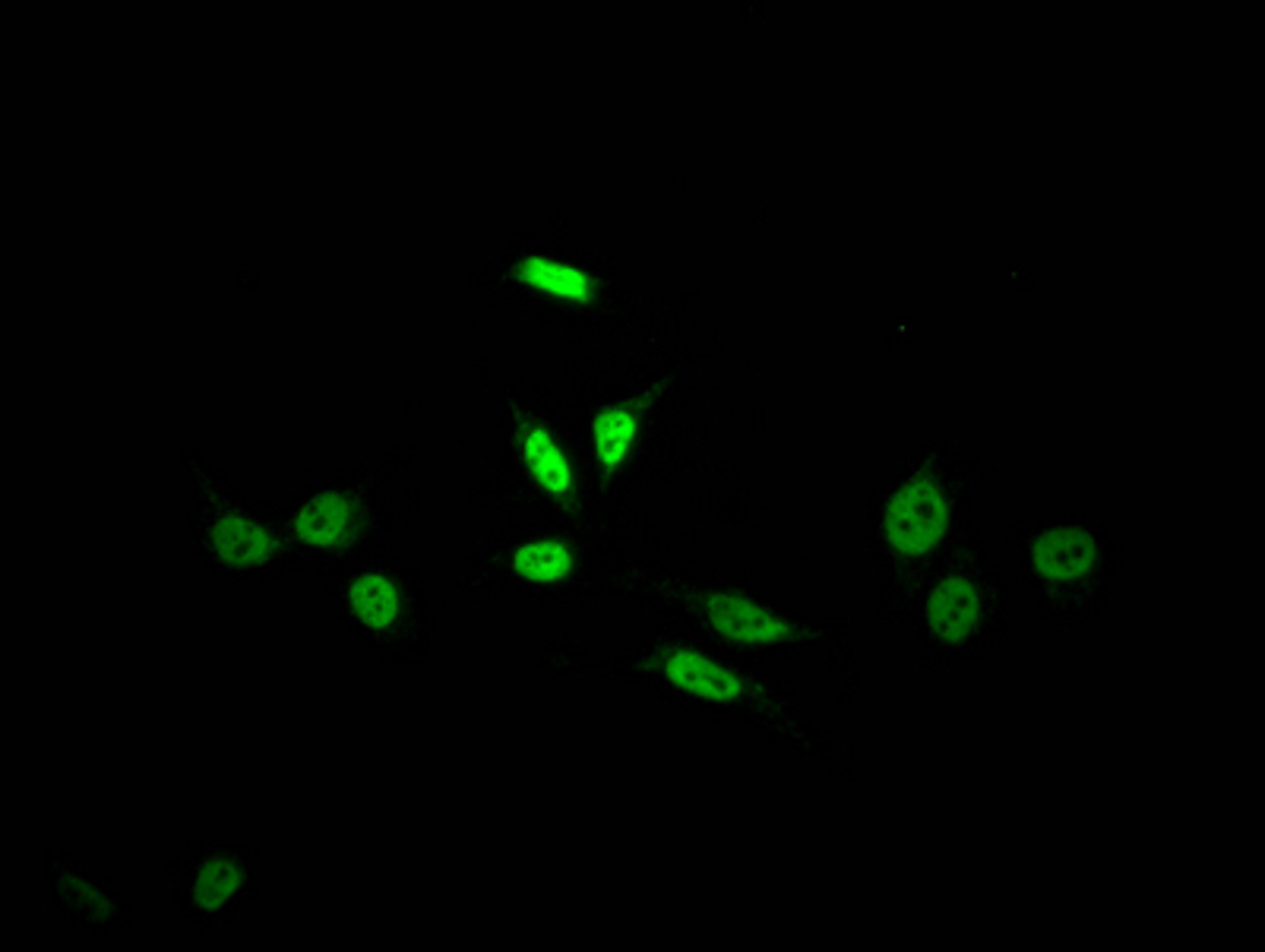 Immunofluorescence staining of HepG2 Cells with CSB-RA155372A0HU at 1:50, counter-stained with DAPI. The cells were fixed in 4% formaldehyde, permeated by 0.2% TritonX-100, and blocked in 10% normal Goat Serum. The cells were then incubated with the antibody overnight at 4℃. Nuclear DNA was labeled in blue with DAPI. The secondary antibody was FITC-conjugated AffiniPure Goat Anti-Rabbit IgG (H+L).