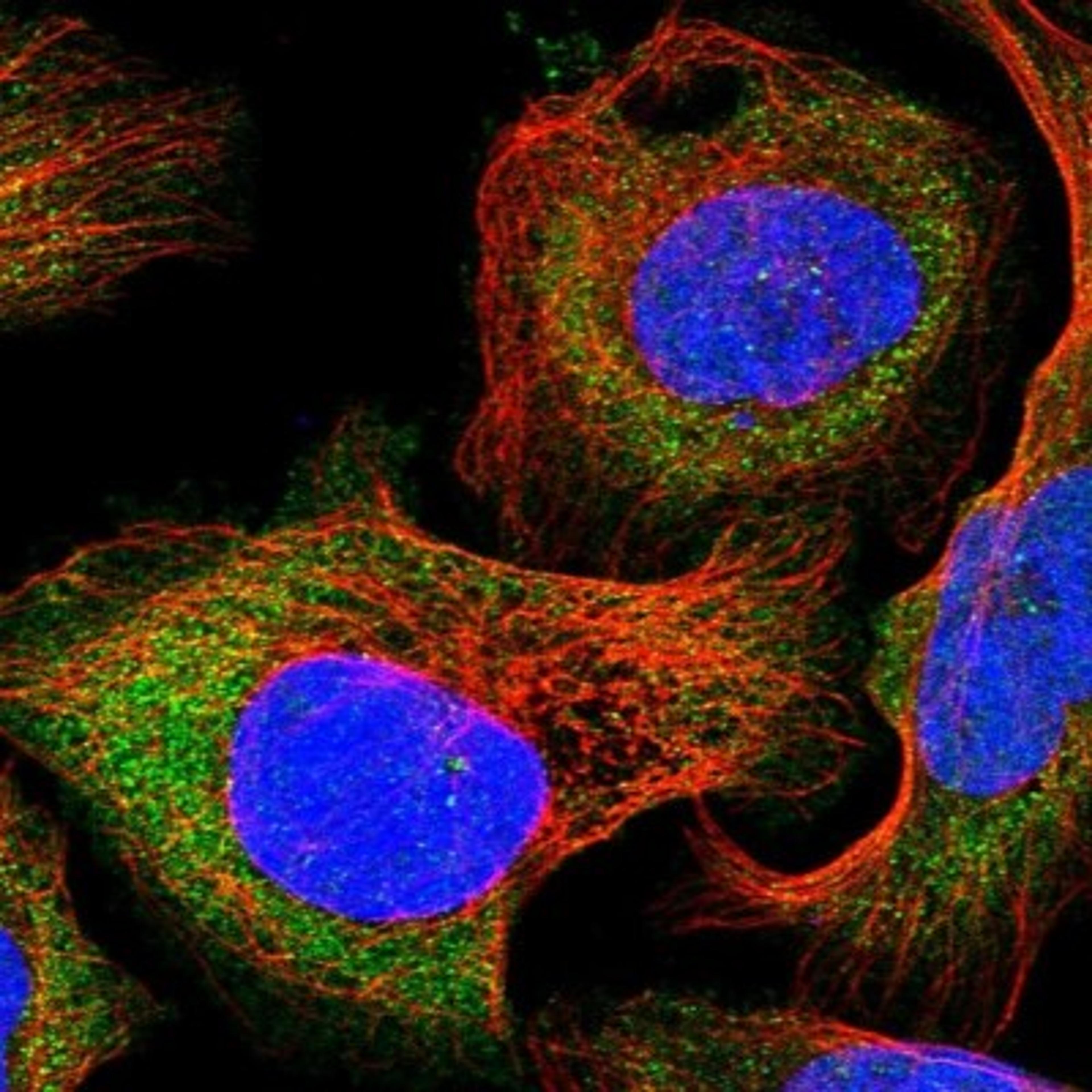 Immunocytochemistry/Immunofluorescence: DAK Antibody [NBP1-84142] - Staining of human cell line U-2 OS shows positivity in cytoplasm.