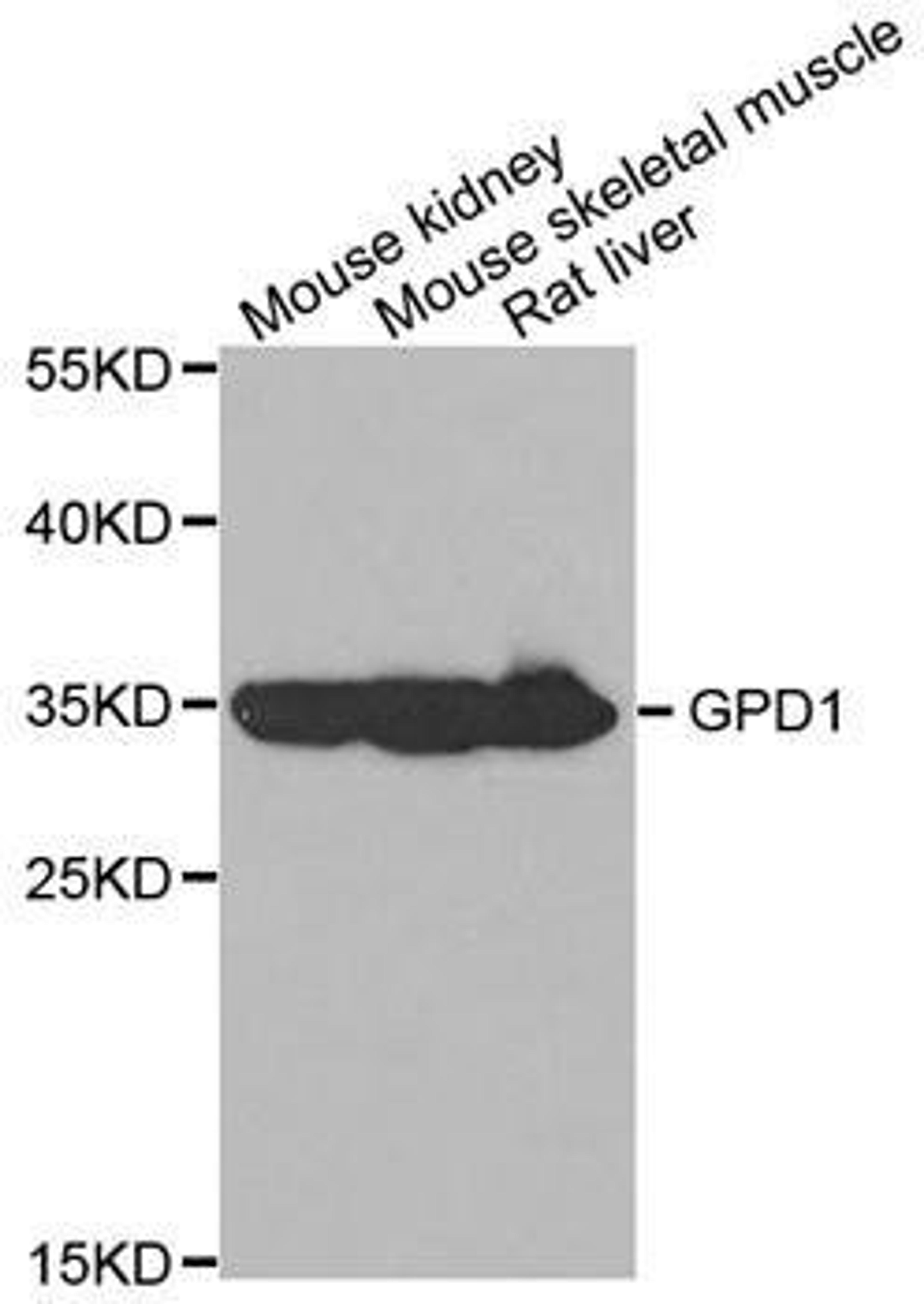 Western blot analysis of extracts of various tissues using GPD1 antibody