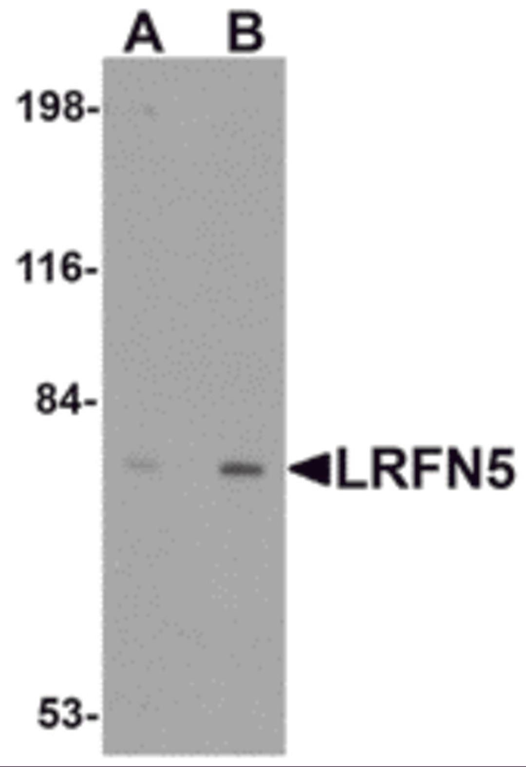 Western blot analysis of LRFN5 in EL4 cell lysate with LRFN5 antibody at (A) 0.5 and (B) 1 &#956;g/mL.