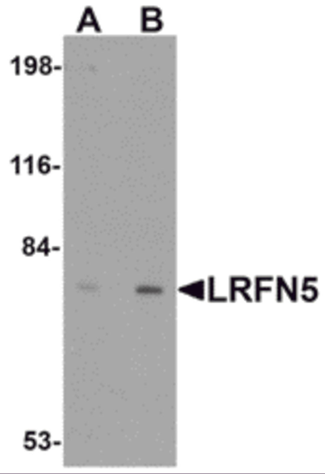 Western blot analysis of LRFN5 in EL4 cell lysate with LRFN5 antibody at (A) 0.5 and (B) 1 μg/mL.