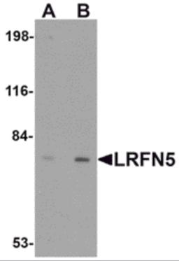 Western blot analysis of LRFN5 in EL4 cell lysate with LRFN5 antibody at (A) 0.5 and (B) 1 μg/mL.