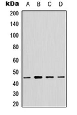 Western blot analysis of A549 (Lane1), HeLa (Lane2), NS-1 (Lane3), PC12 (Lane4) whole cell using GTPBP5 antibody