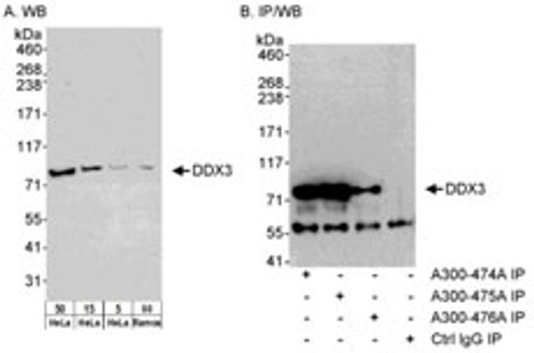 Detection of DDX3 by western blot and immunoprecipitation.