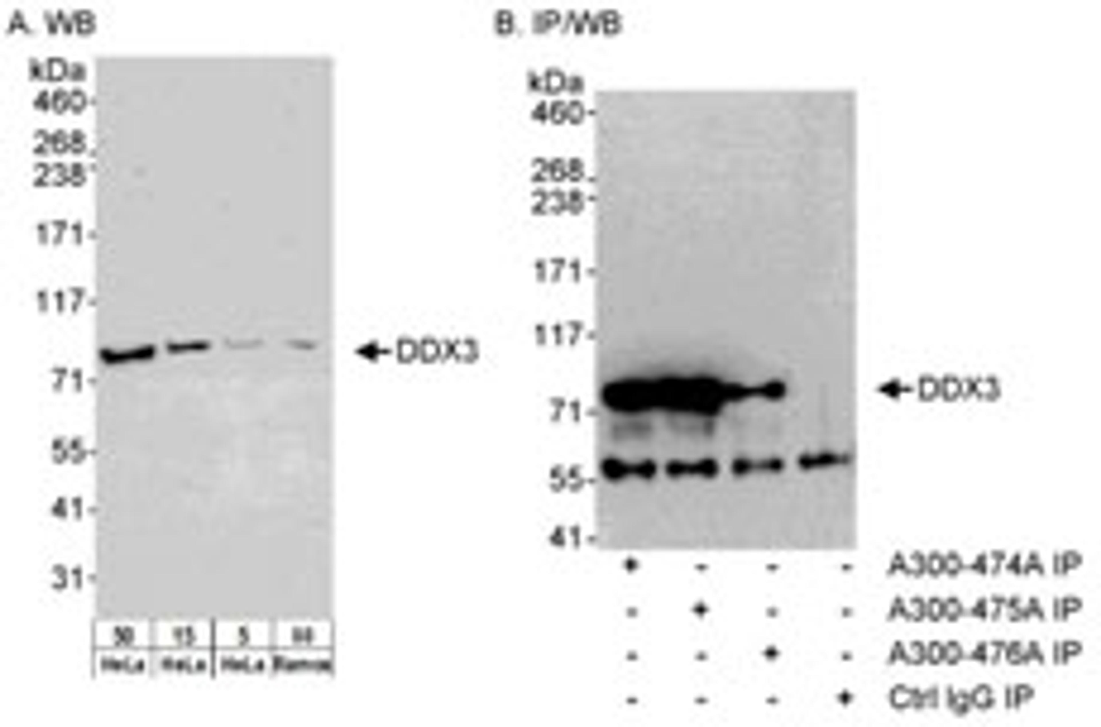 Detection of DDX3 by western blot and immunoprecipitation.