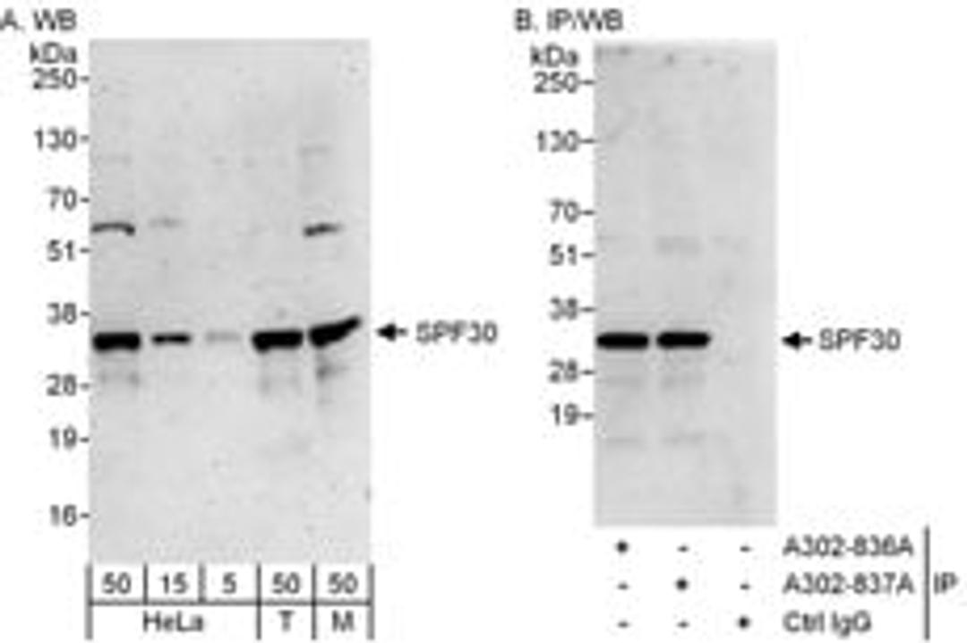 Detection of human and mouse SPF30 by western blot (h&m) and immunoprecipitation (h).